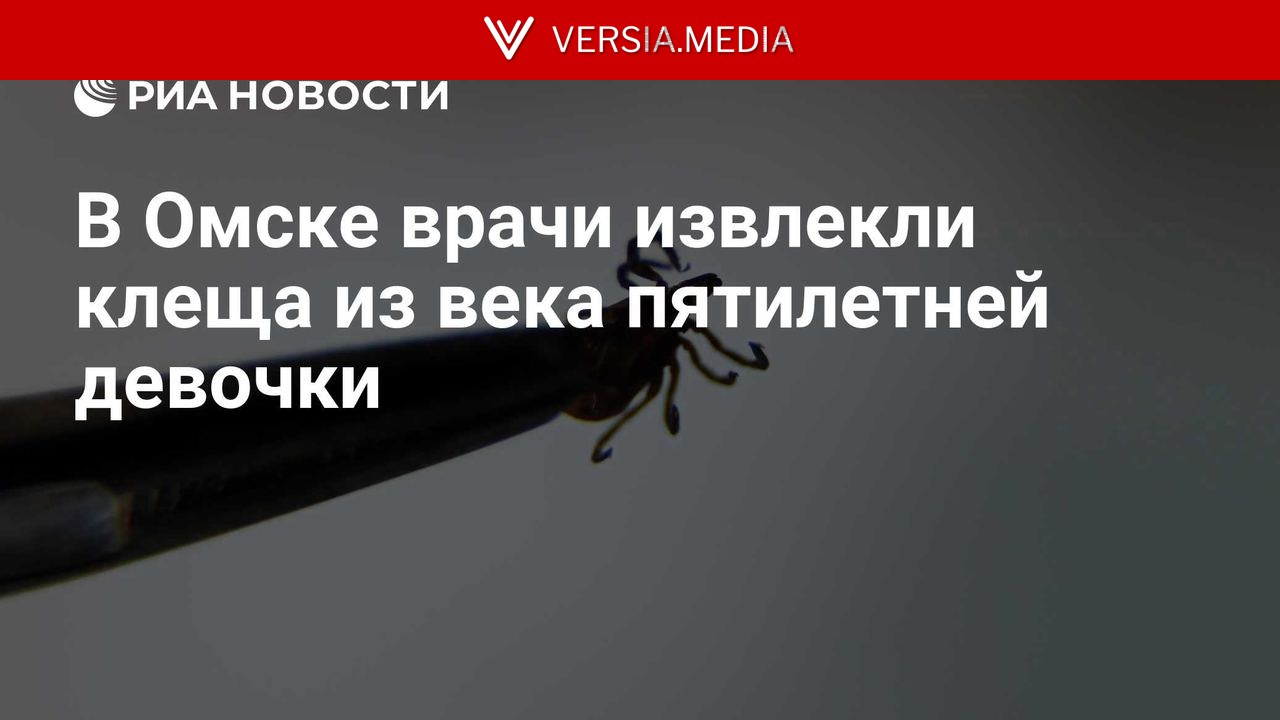В Омске врачи извлекли клеща из века пятилетней девочки