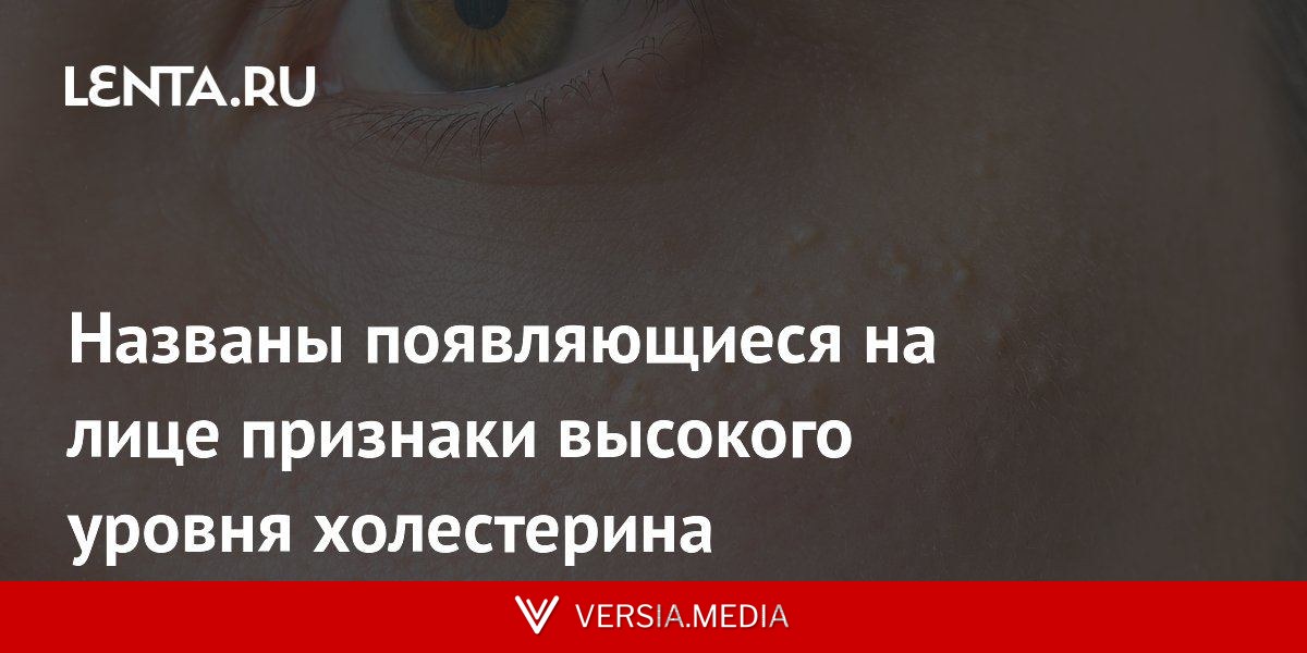 Названы появляющиеся на лице признаки высокого уровня холестерина