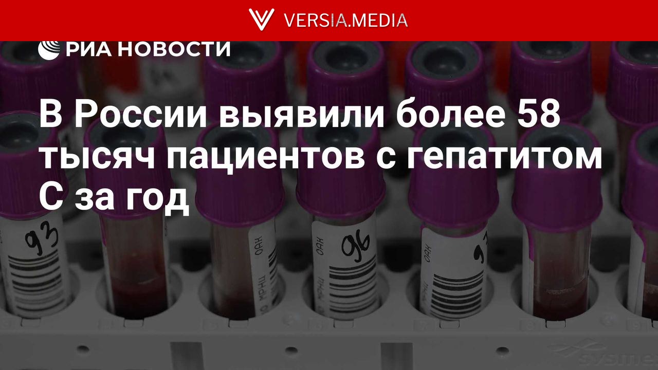 В России выявили более 58 тысяч пациентов с гепатитом C за год